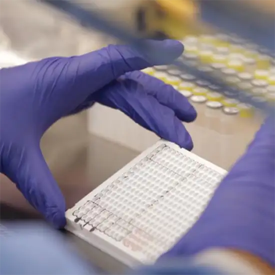 leptospira detection pcr test